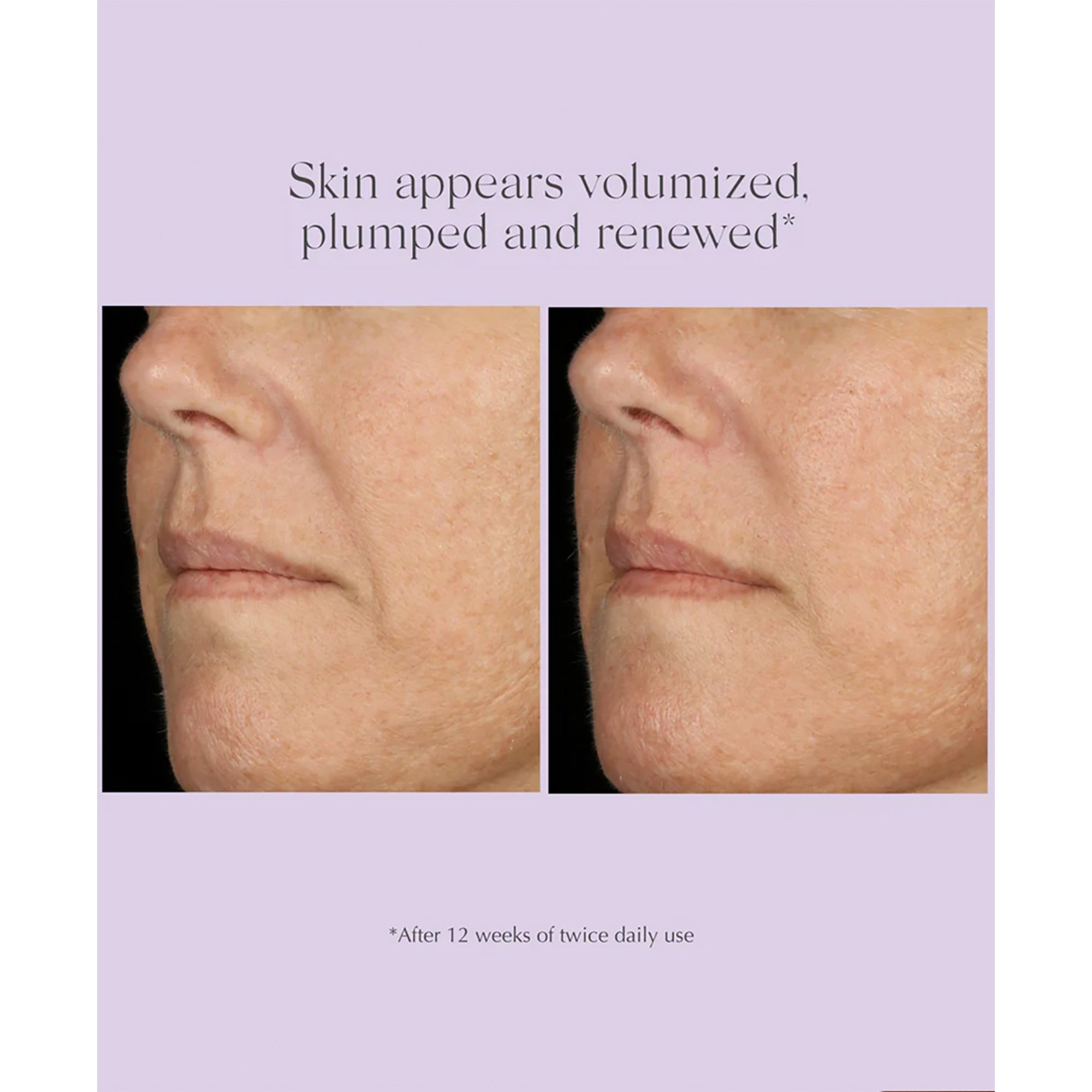 Exuviance Age Reverse Total Correct + Sculpt Serum 30 ml (obrázok 10)