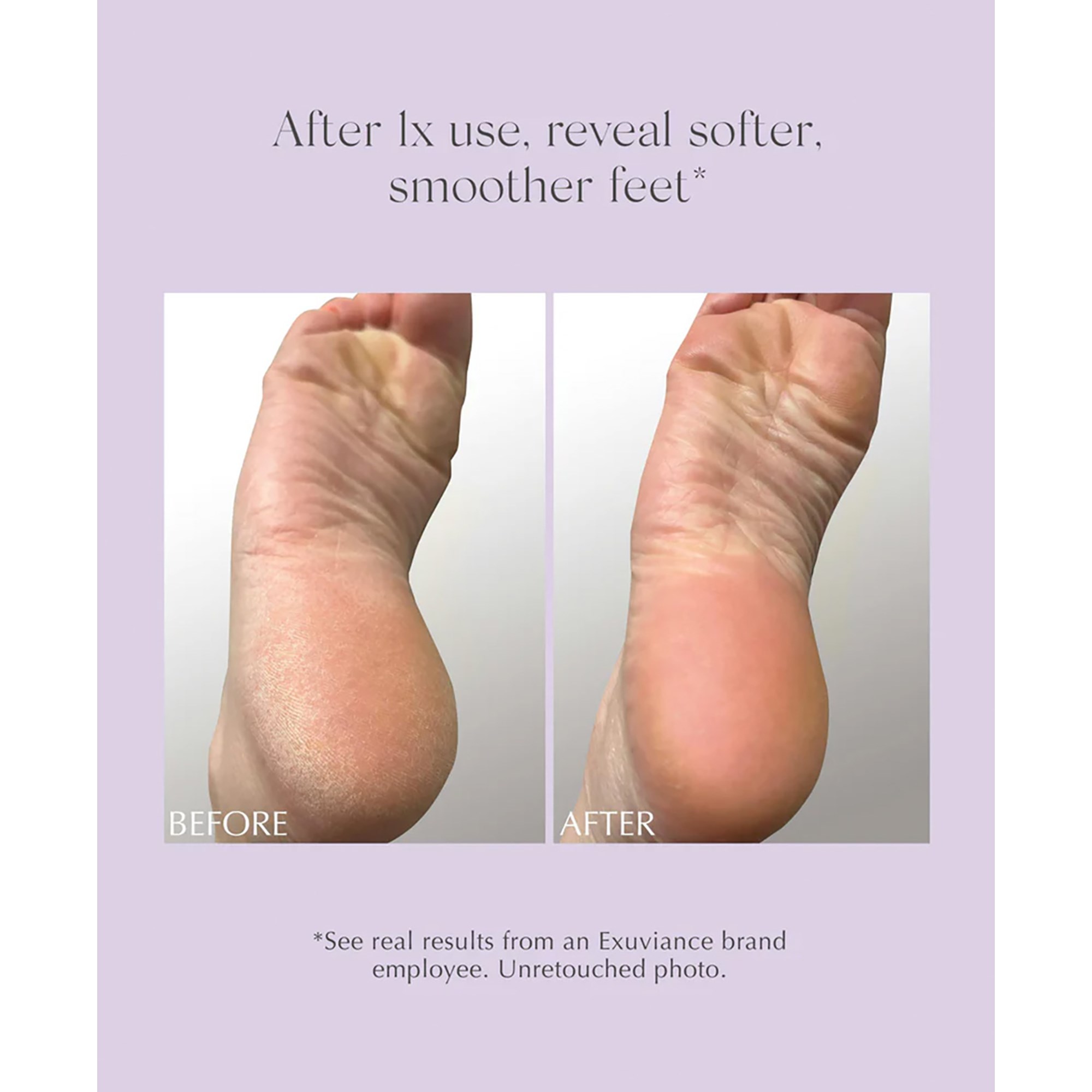 Exuviance Exfoliating & Conditioning Foot Balm 50 g (obrázok 9)