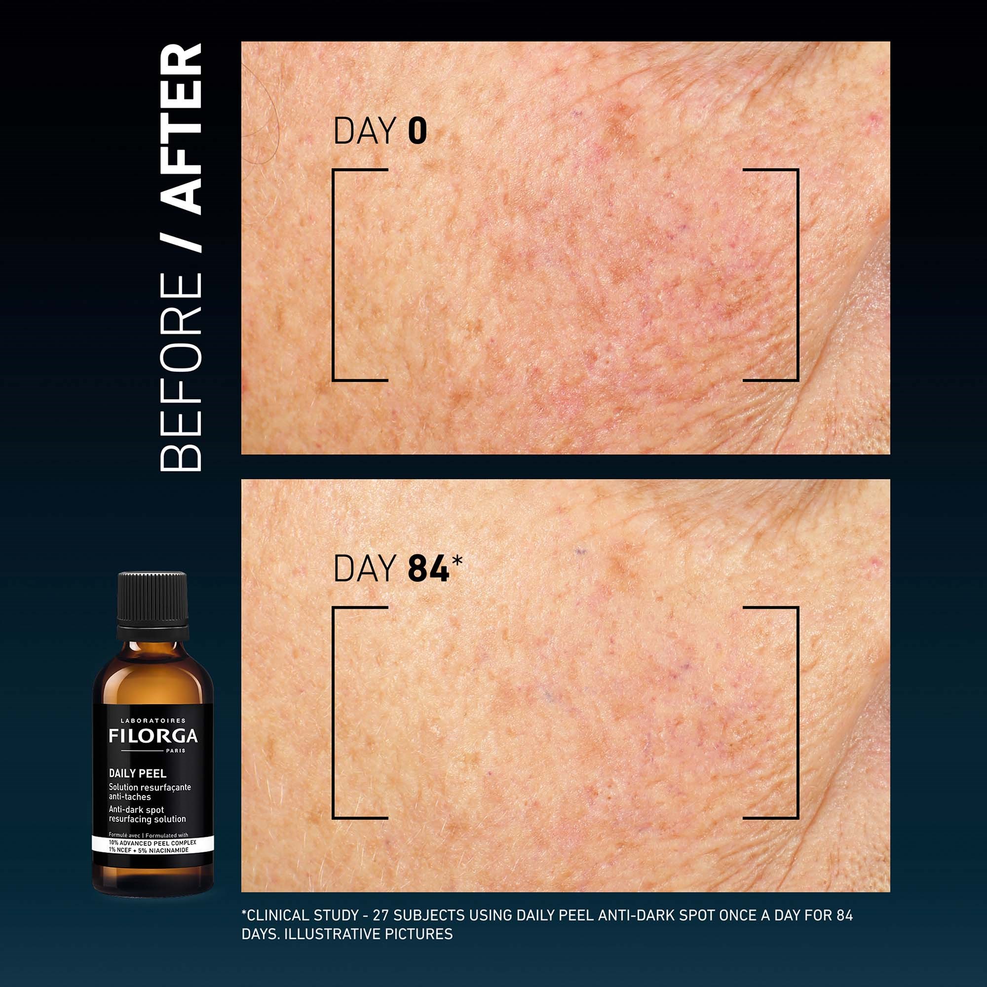 FILORGA Daily Peel Anti-Dark Spot Resurfacing Solution 50 ml (obrázok 6)