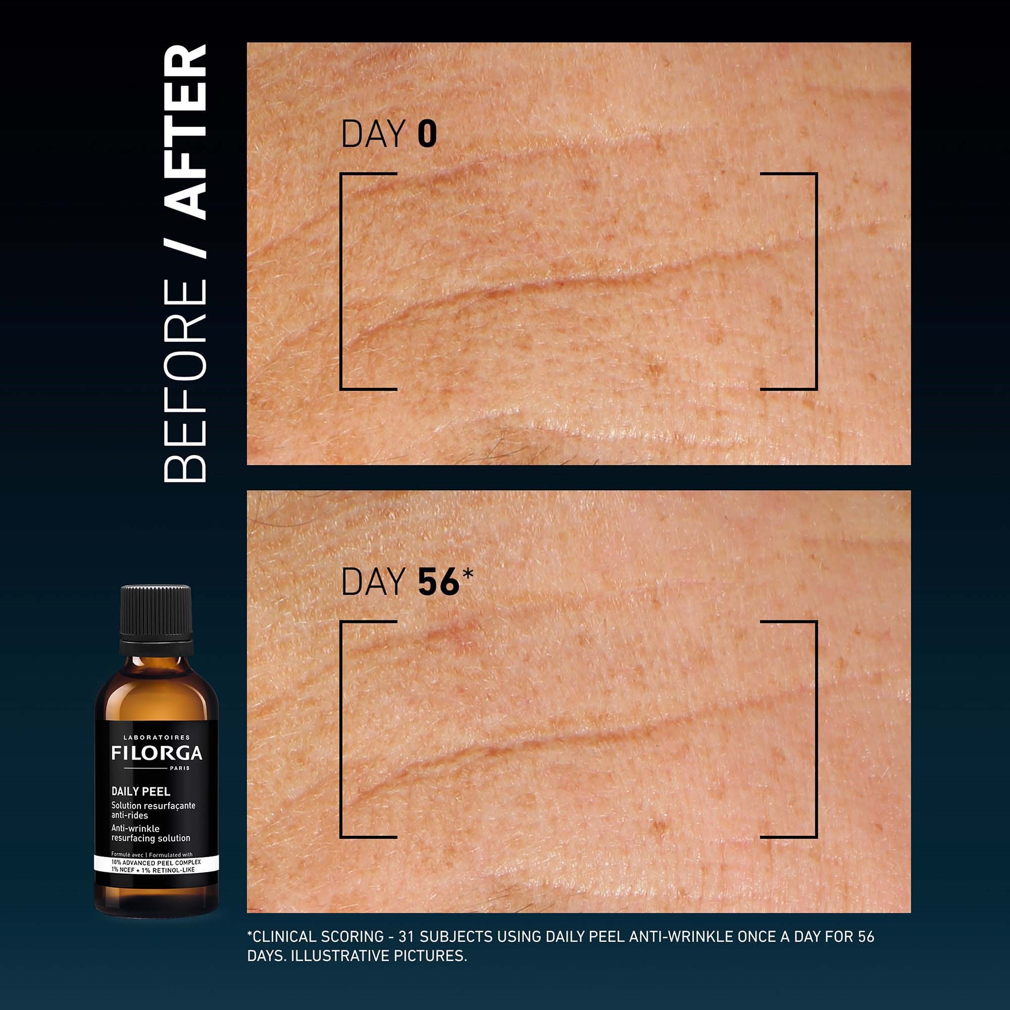 FILORGA Daily Peel Anti-Wrinkle Resurfacing Solution 50 ml (obrázok 6)