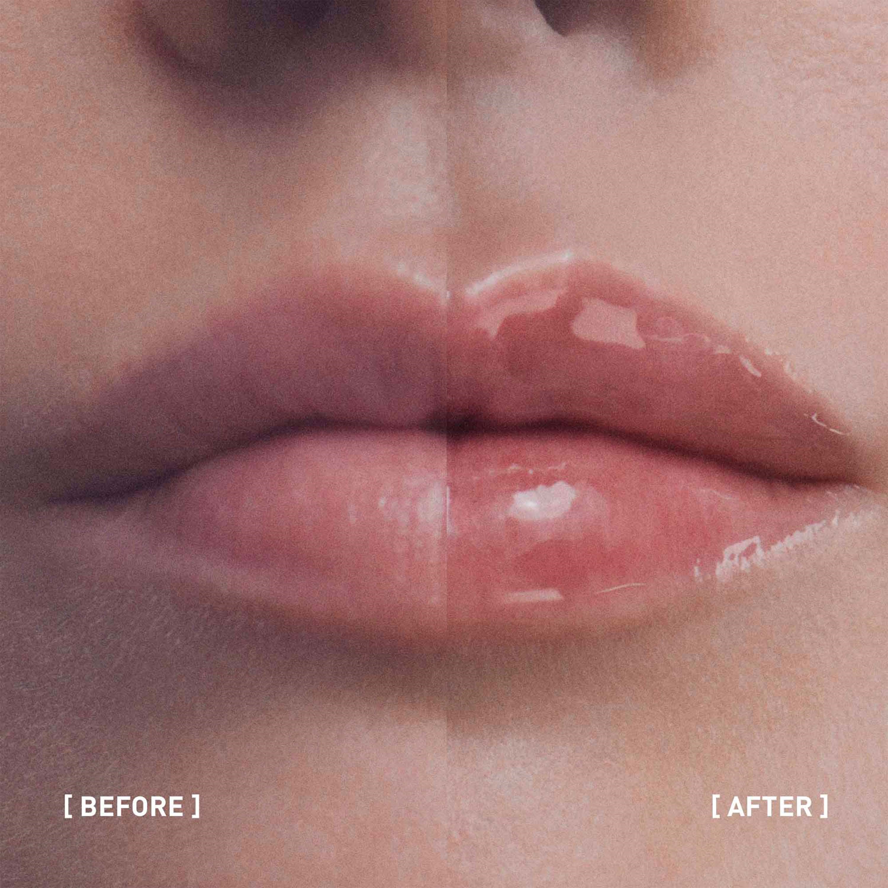 FILORGA Hyalu-Filler Lips 4 g (obrázok 5)