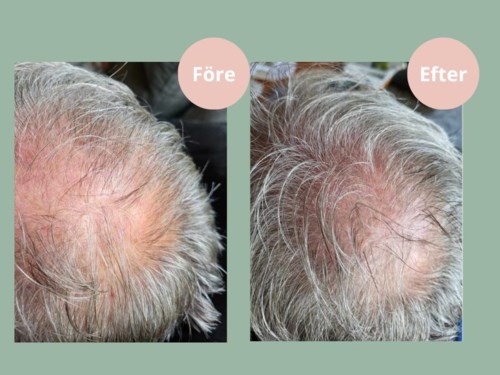 Кондиционер для волос Hjartligt Hair Growth для роста волос, для истончённых волос, 250 мл — фото 3