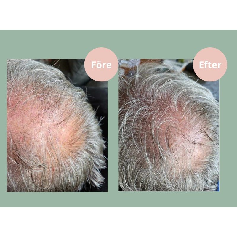 Hjärtligt Hair Growth Conditioner 250 ml (obrázok 3)