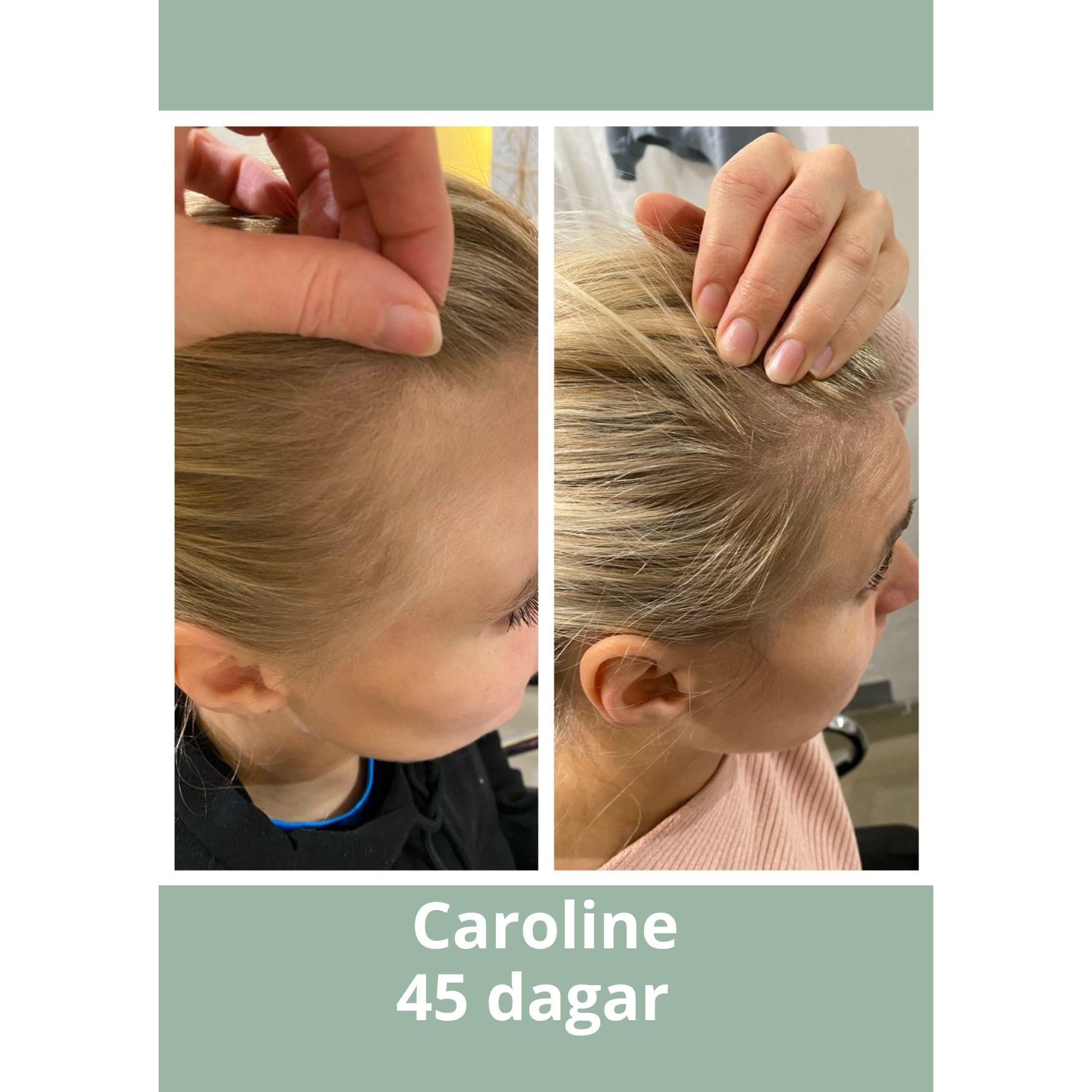Hjärtligt Hair Growth Elixir 50 ml (obrázok 3)