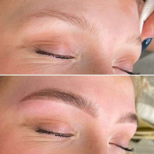 Before and after of eyebrow shaping or makeup, showing more defined eyebrows after treatment.