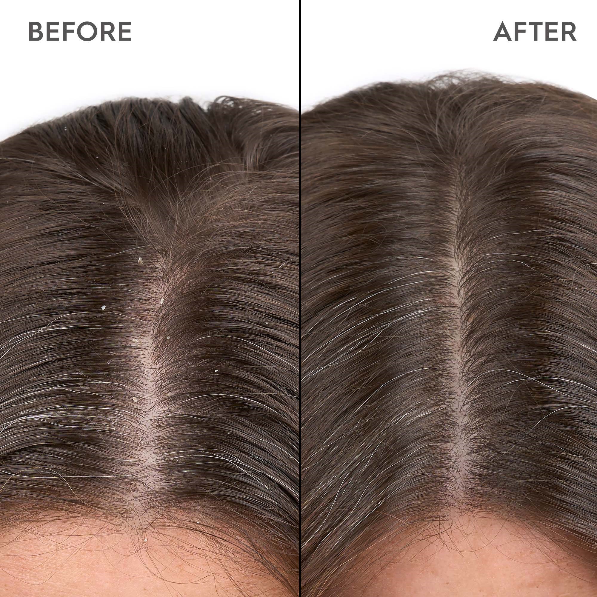 Kerasilk SPECIALISTS Anti-Dandruff Scalp Serum 100 ml (obrázok 4)