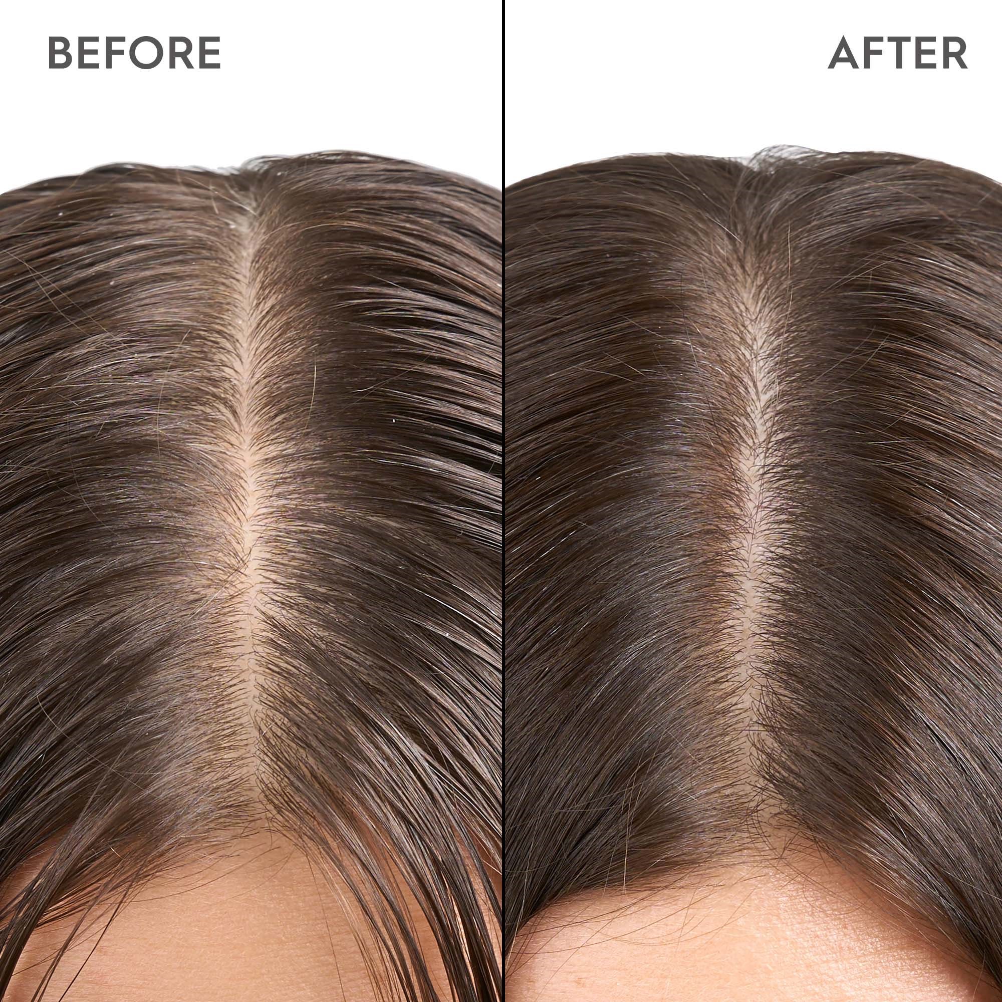 Kerasilk SPECIALISTS Exfoliating Scalp & Hair Treatment 200 ml (obrázok 4)
