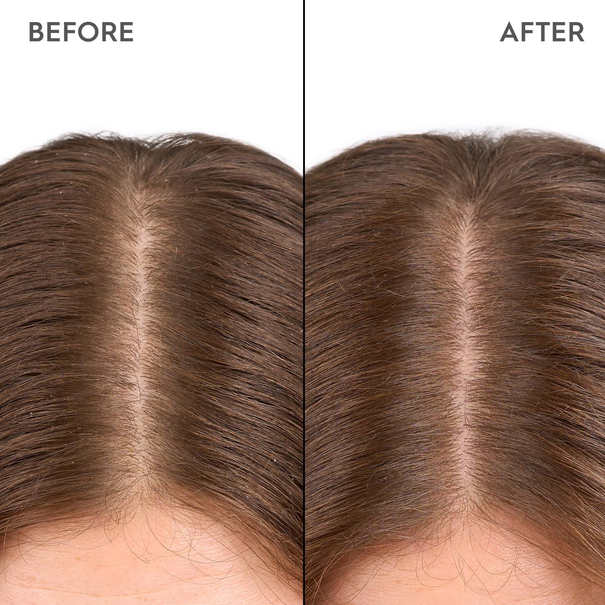 Kerasilk SPECIALISTS Moisturizing Scalp Drops 100 ml (obrázok 4)