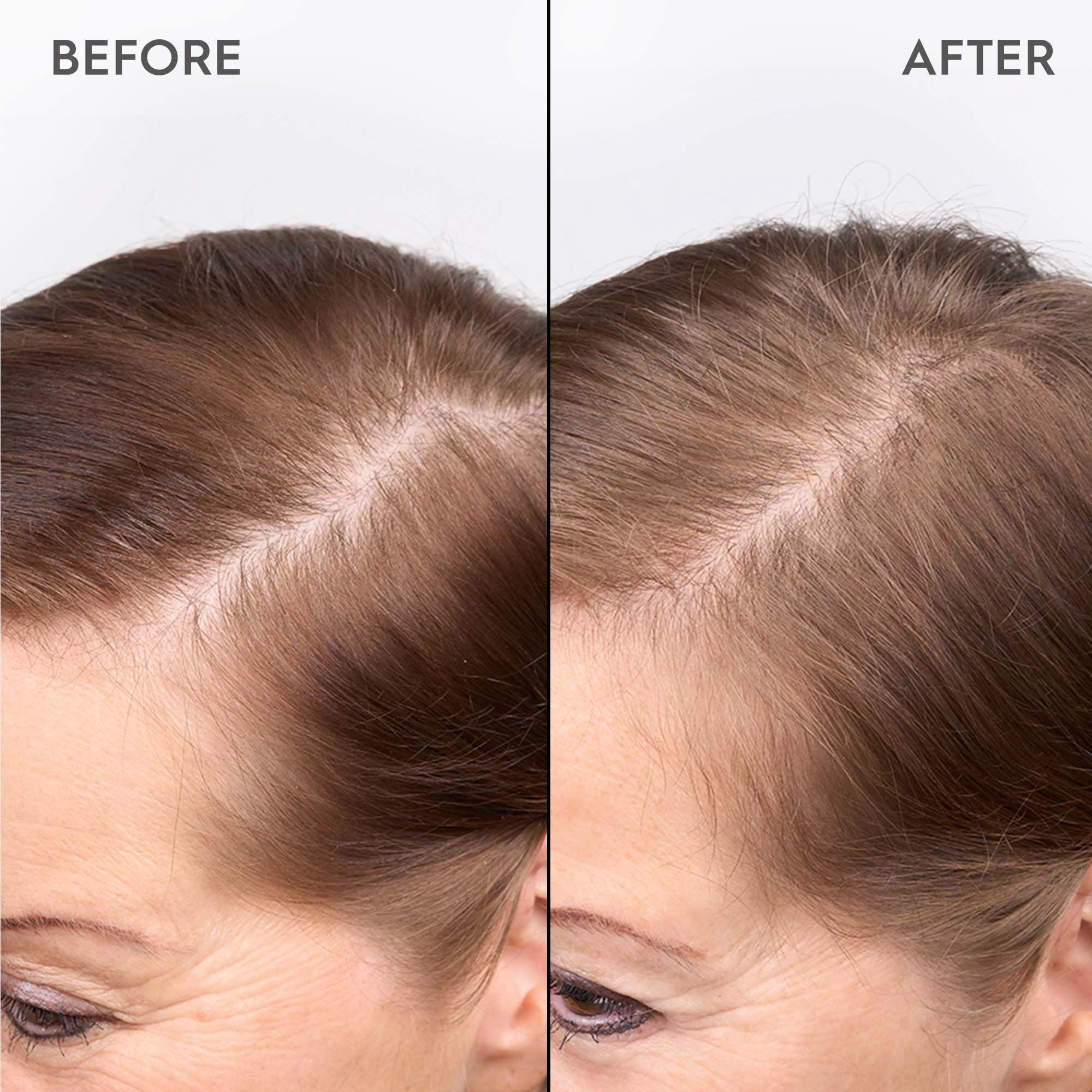 Kerasilk SPECIALISTS Redensifying Scalp Serum 100 ml (obrázok 4)