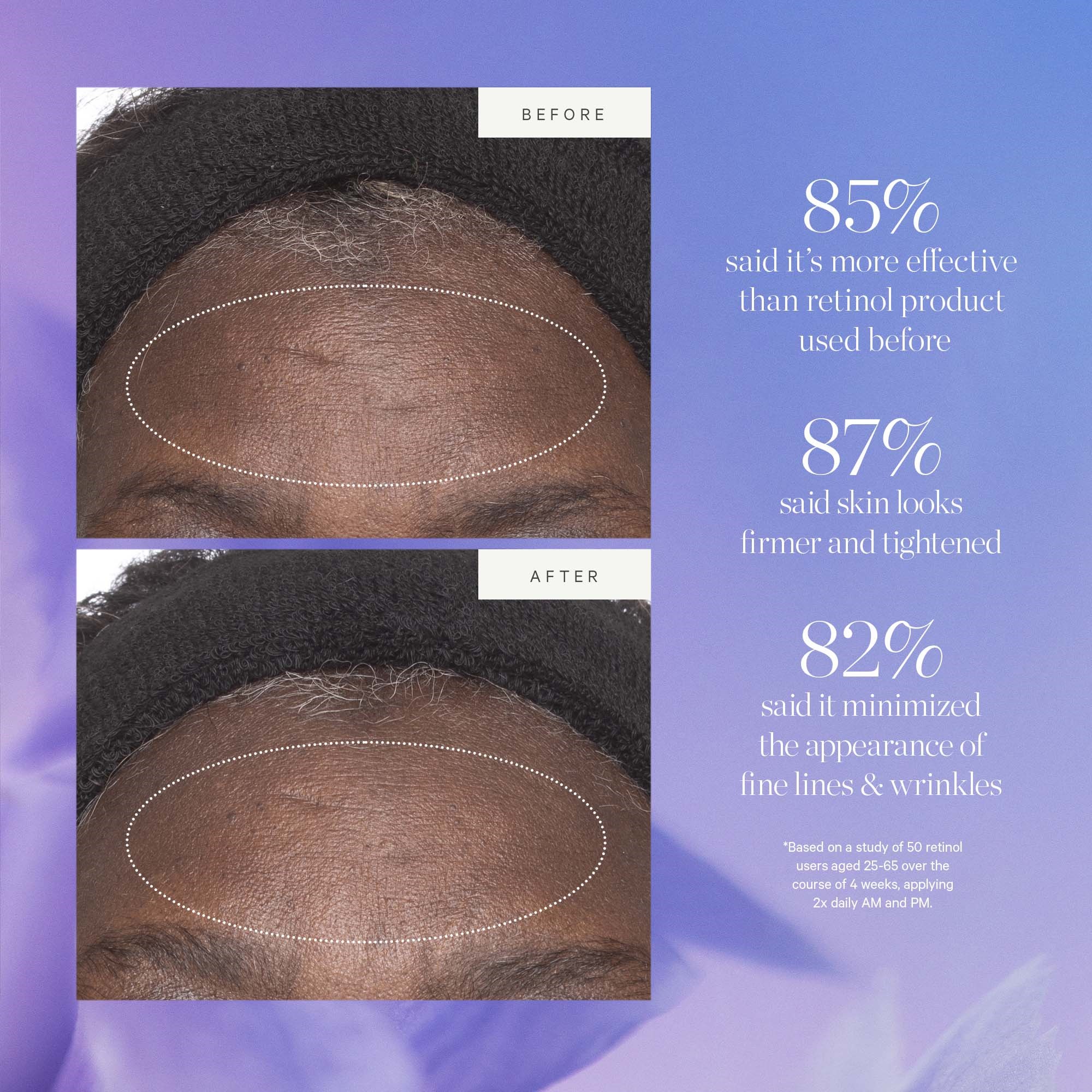 KORA Organics Plant Stem Cell Retinol Alternative Moisturizer 15 ml (obrázok 4)