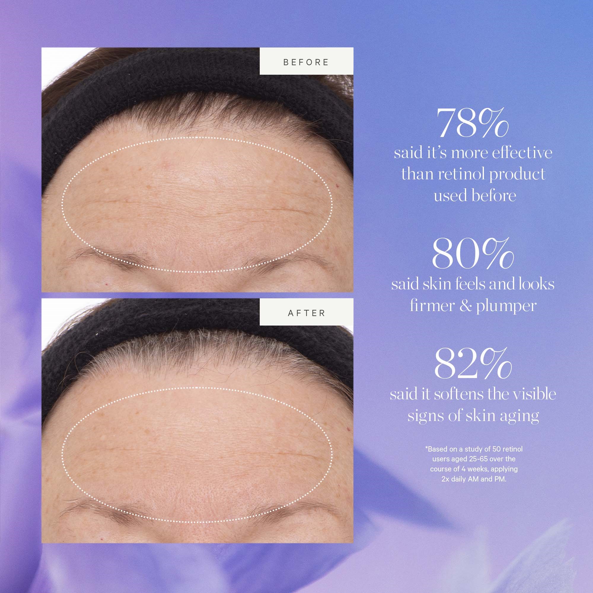 KORA Organics Plant Stem Cell Retinol Alternative Serum - serum do twa (obrázok 4)