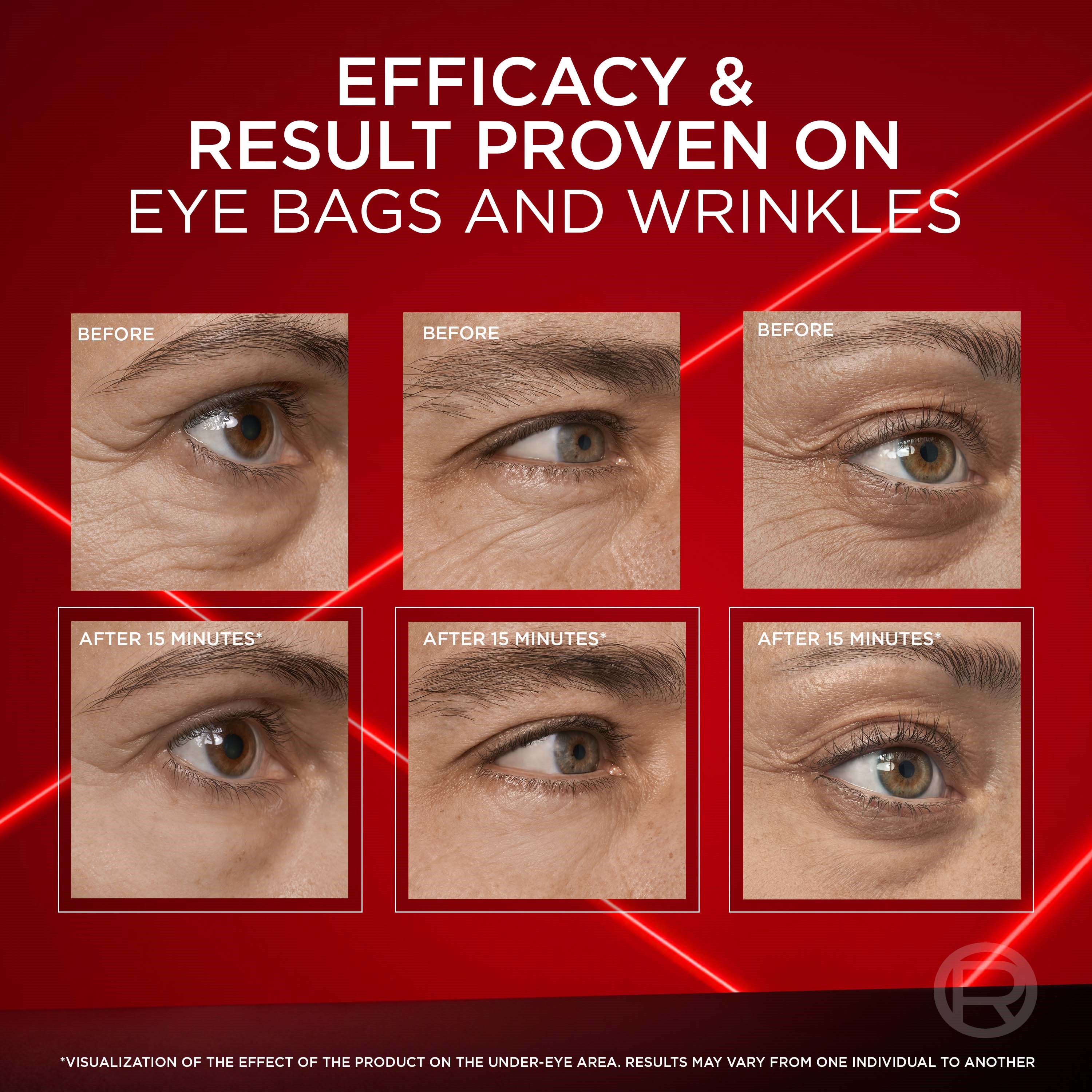 L'Oréal Paris Revitalift Laser Eye Bag Eraser 15 ml (obrázok 9)