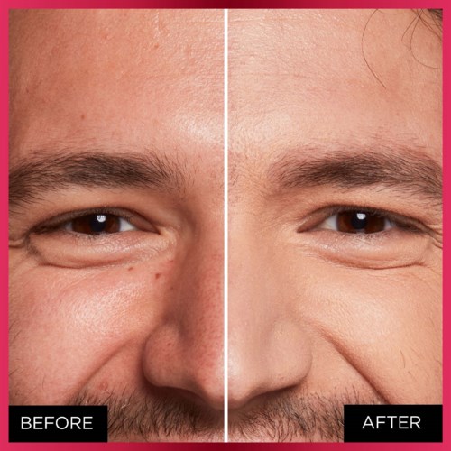 Side-by-side photo of a man's face showing before and after skin improvement, especially around the eyes.