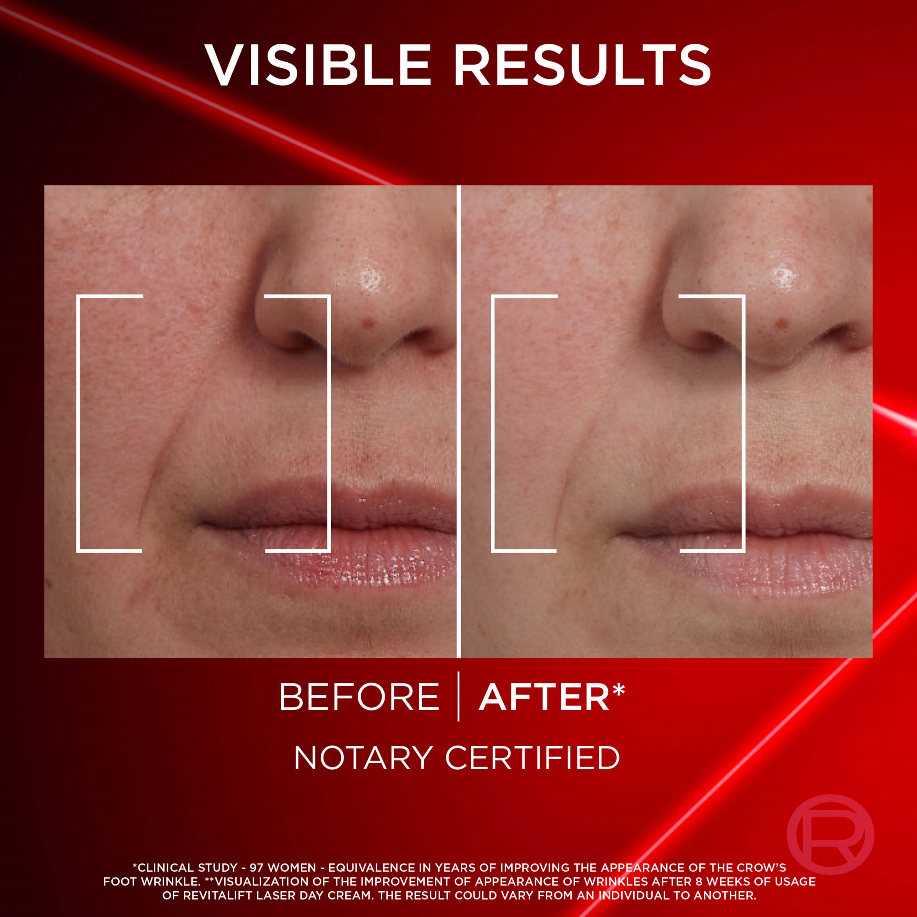 L'Oréal Paris Revitalift Laser Day Cream 50 ml & Laser Eye Bag Instant (obrázok 10)
