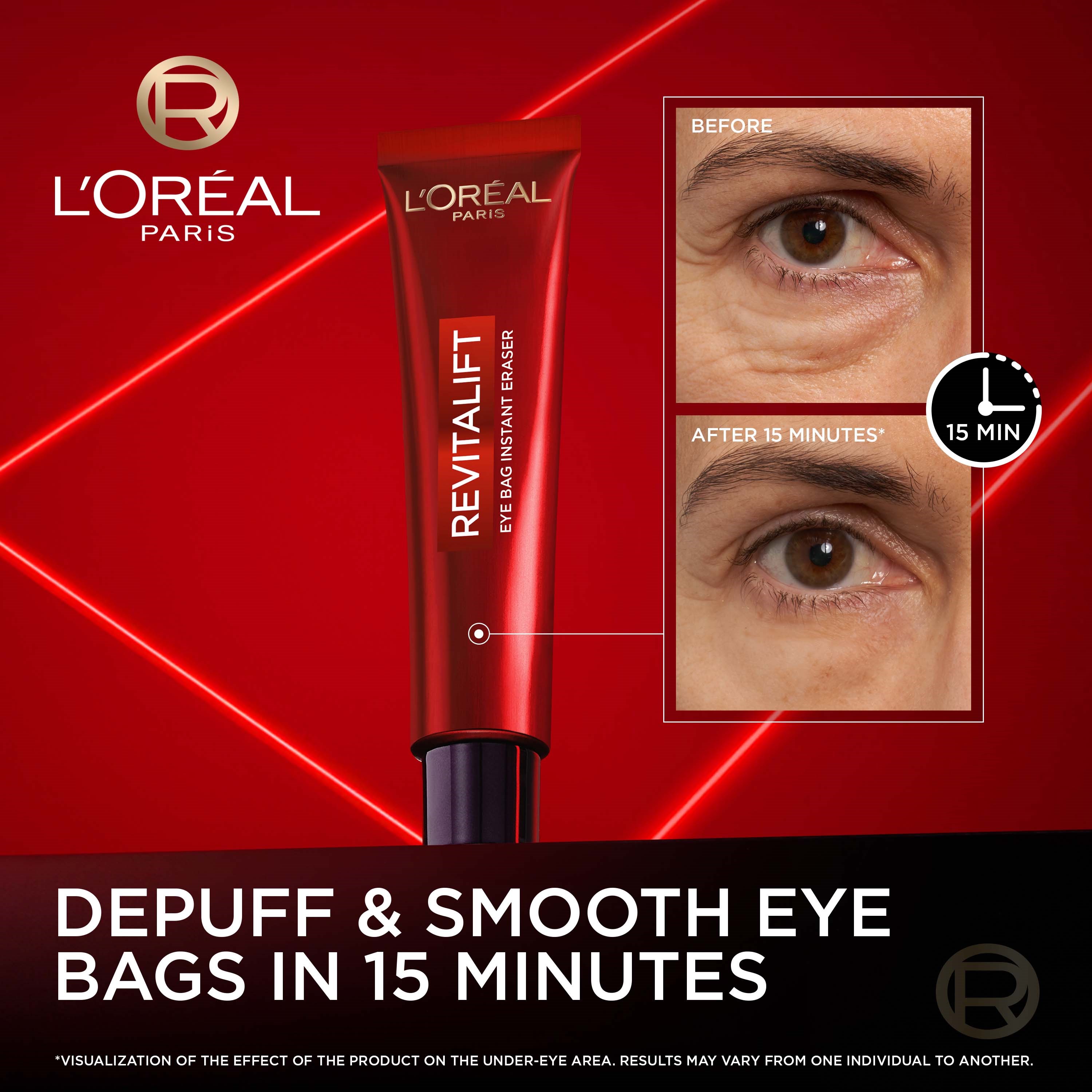 L'Oréal Paris Revitalift Laser Day Cream 50 ml & Laser Eye Bag Instant (obrázok 3)