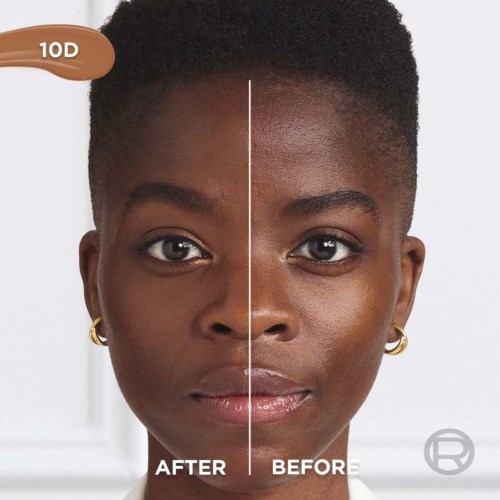 Side-by-side face showing improved skin texture after skincare treatment. Clear difference between before and after.