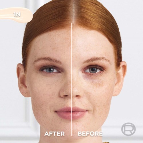 Side-by-side face showing reduction in dark spots and clearer skin after treatment.