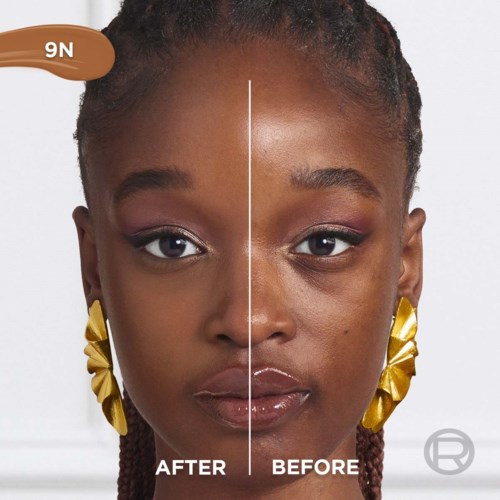A woman shows a side-by-side comparison of her face before and after treatments, focusing on skin and facial appearance.