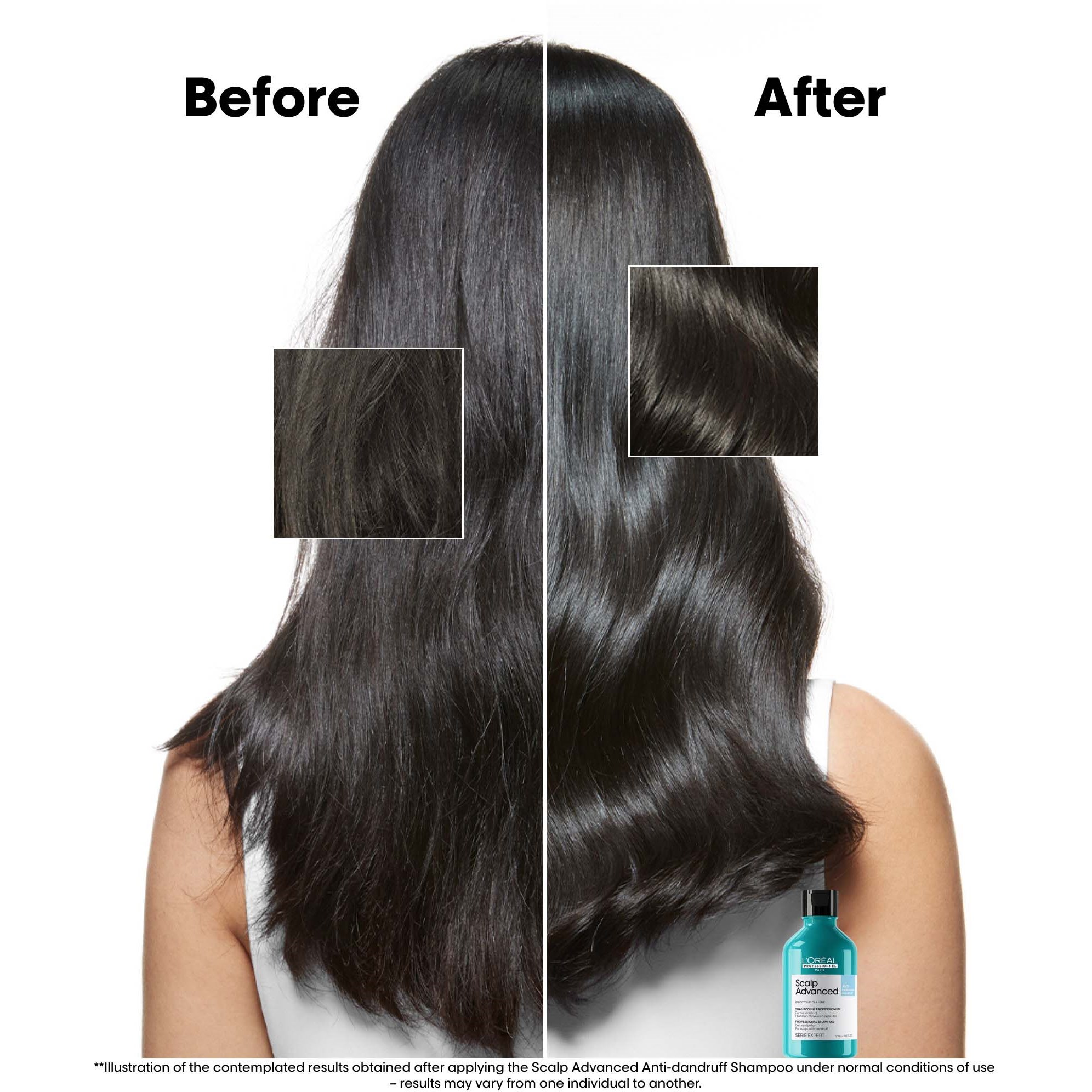 L'Oréal Professionnel Scalp Advanced Professional Shampoo 300 ml (obrázok 3)