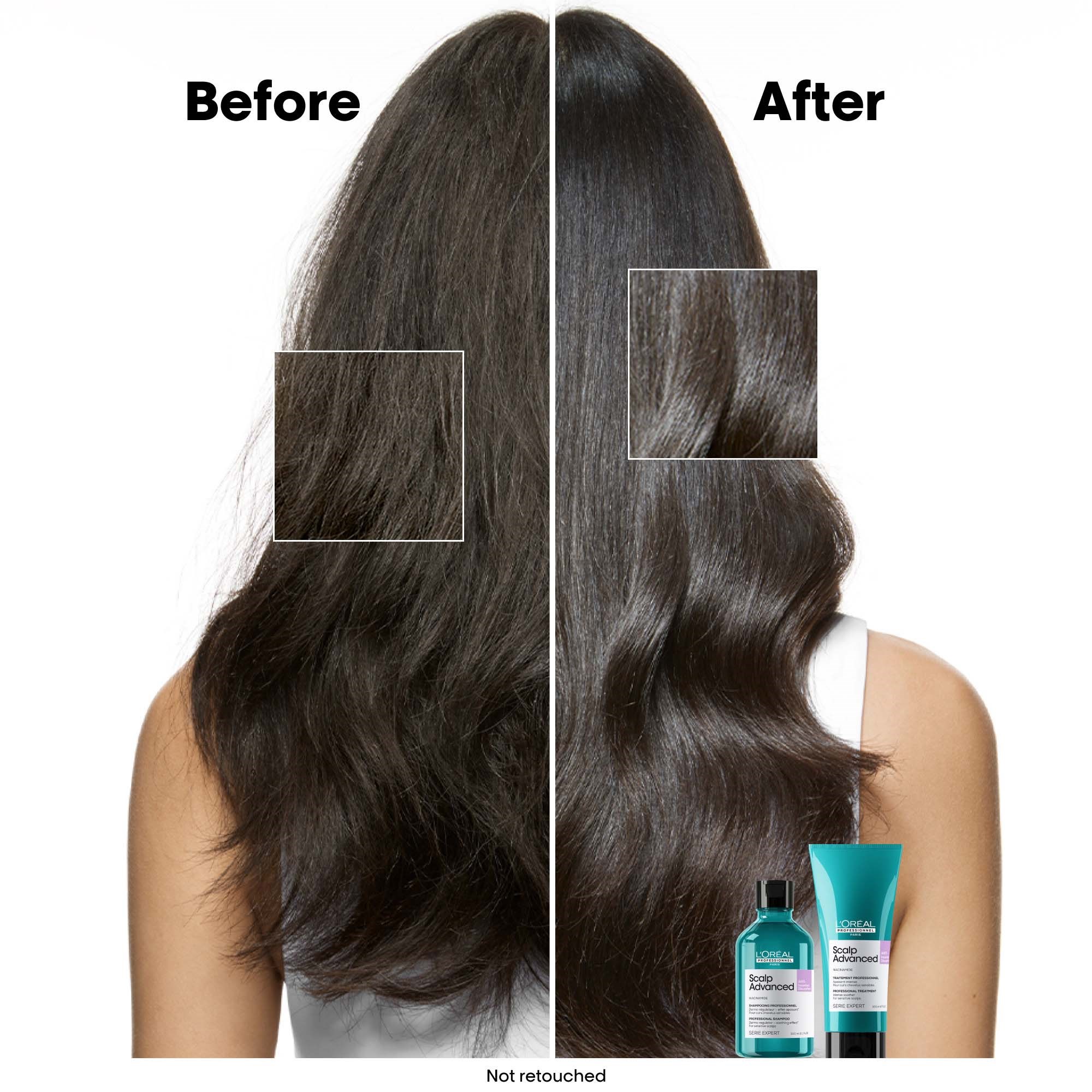 L'Oréal Professionnel Scalp Advanced Anti-Discomfort Treatment 300 ml (obrázok 3)