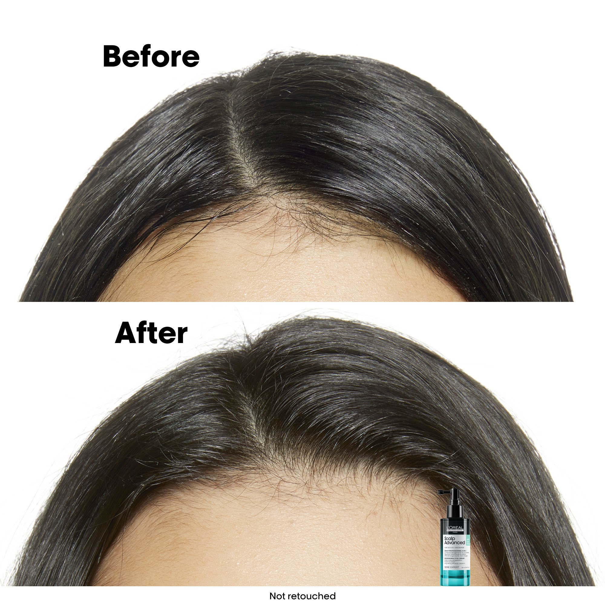 L'Oréal Professionnel Scalp Advanced Anti-Discomfort Treatment 500 ml (obrázok 4)