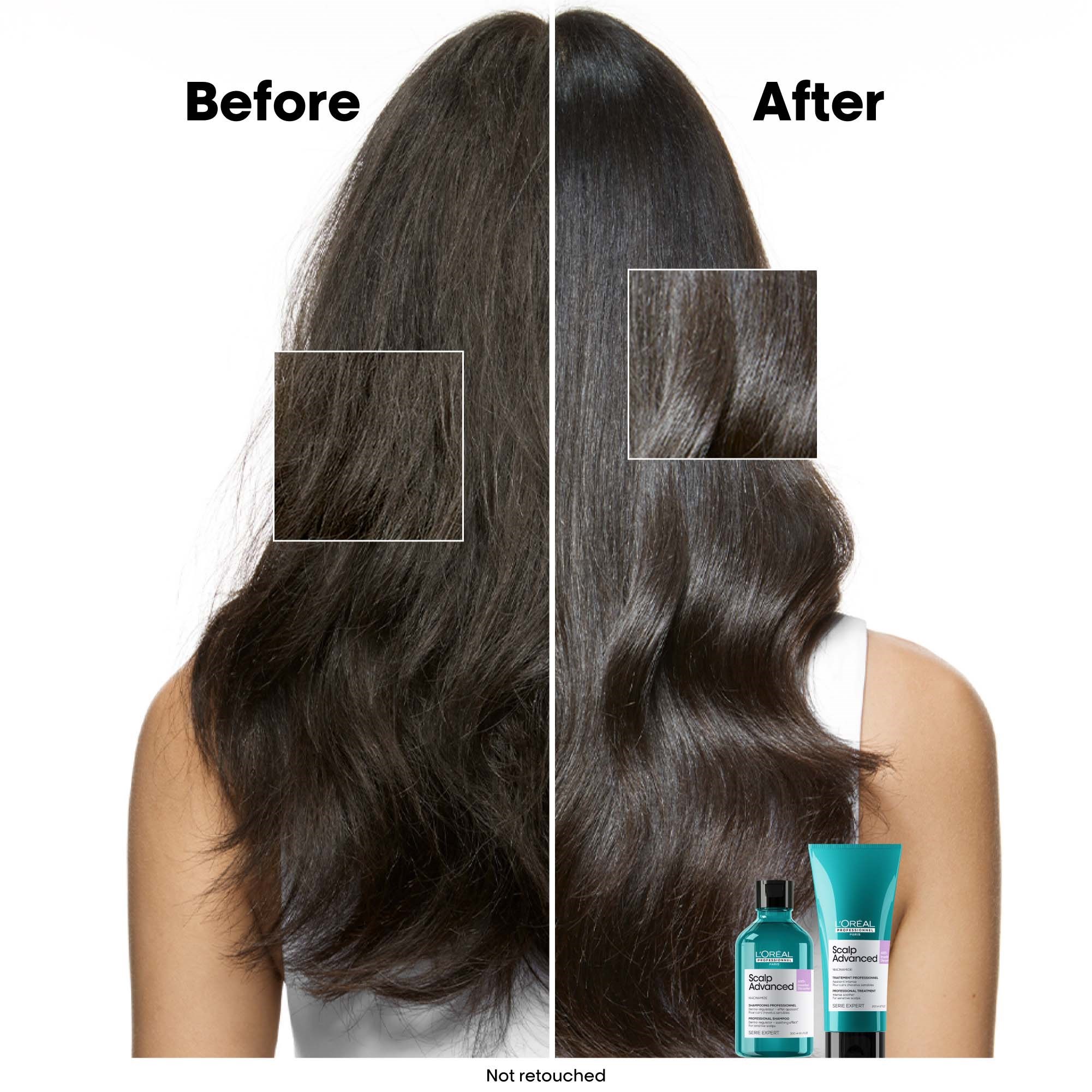 L'Oréal Professionnel Scalp Advanced Anti-Discomfort Shampoo Refill (obrázok 3)