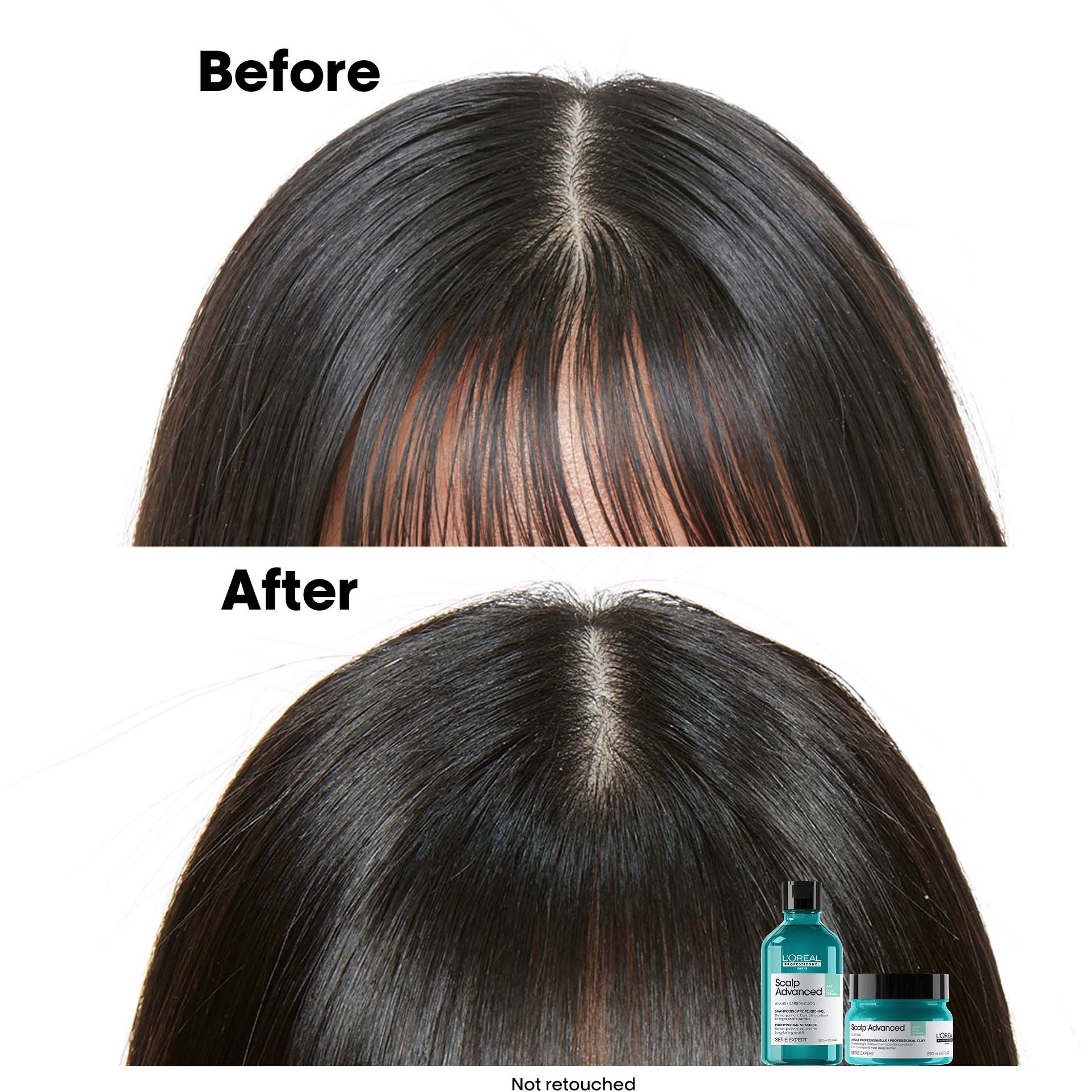 L'Oréal Professionnel Scalp Advanced Professional Clay 250 ml (obrázok 4)