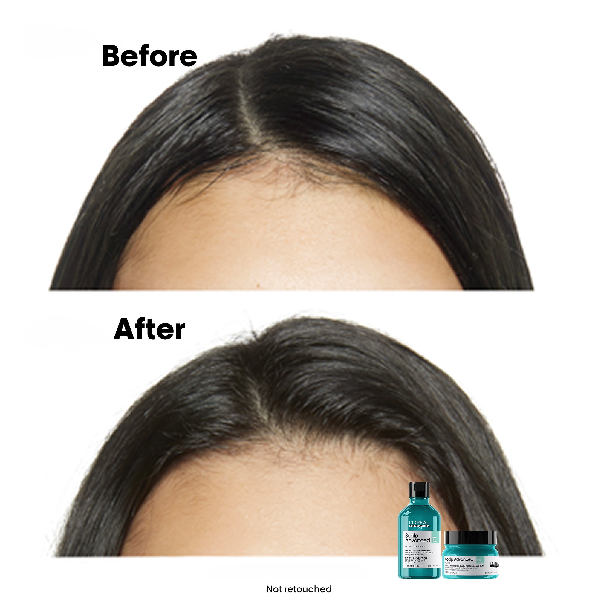 L'Oréal Professionnel Scalp Advanced Professional Shampoo For Oily Sca (obrázok 3)