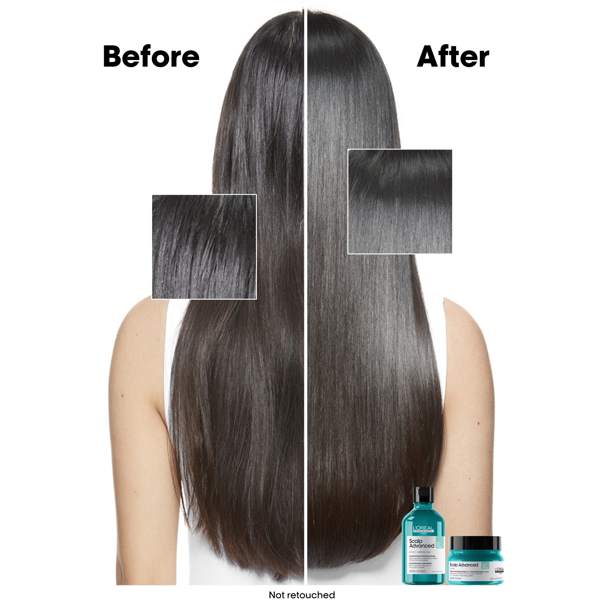 L'Oréal Professionnel Scalp Advanced Professional Shampoo For Oily Sca (obrázok 4)