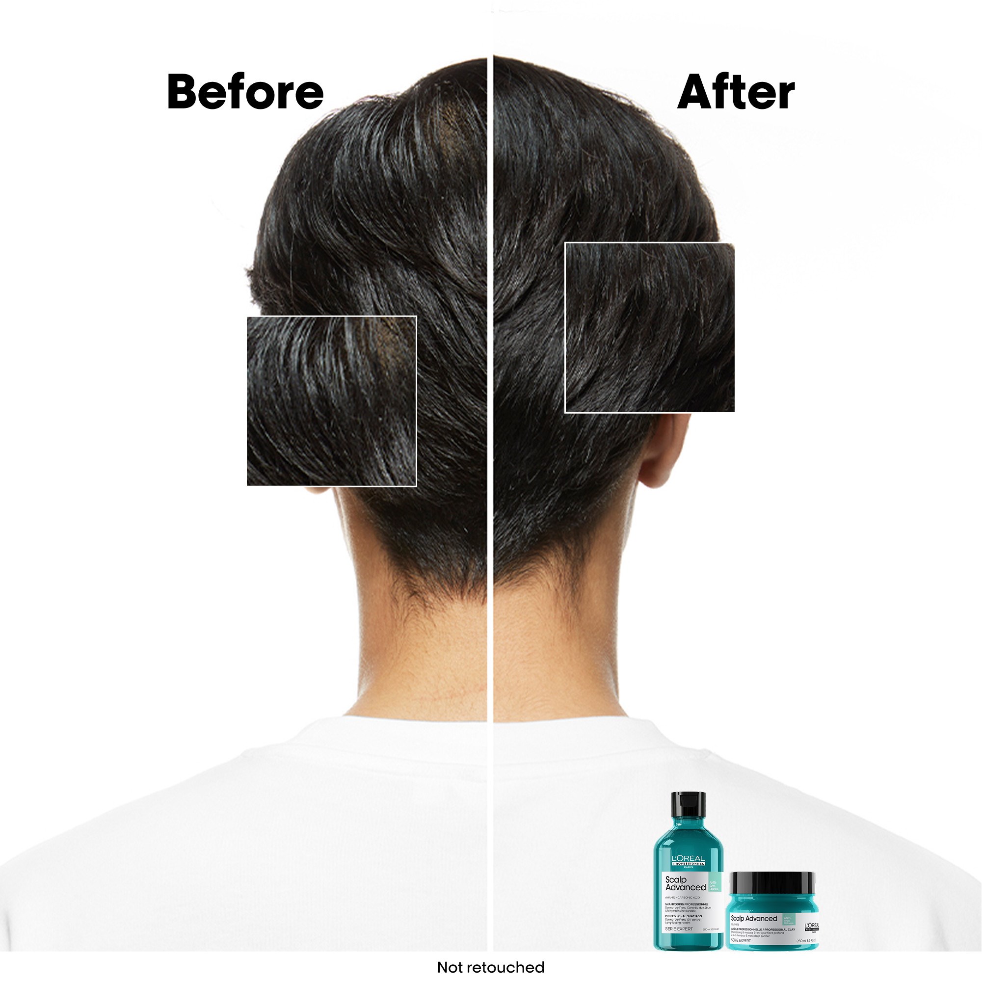 L'Oréal Professionnel Scalp Advanced Professional Shampoo For Oily Sca (obrázok 5)