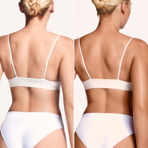 Side-by-side images show before and after body shaping or skin smoothing, highlighting changes in appearance.