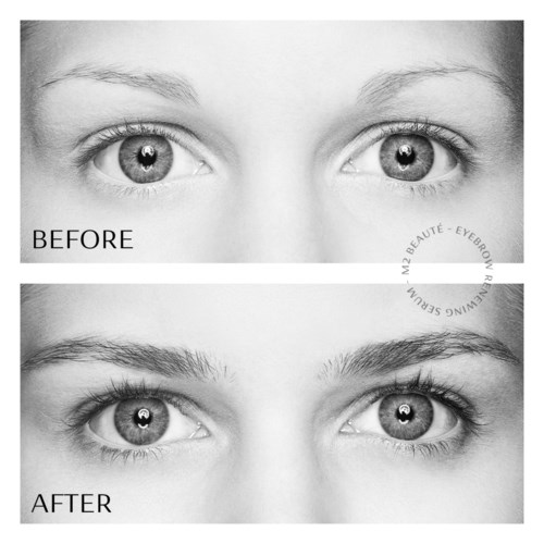 Nahaufnahme von Augen mit Vorher- und Nachher-Bildern von Wimpern- oder Augenbrauenverlängerung. Augen sehen nach Behandlung definierter und voller aus.
