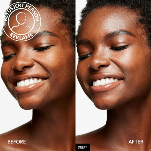 Het gezicht van een vrouw voor en na een cosmetische huidbehandeling, met egalere, helder skin.