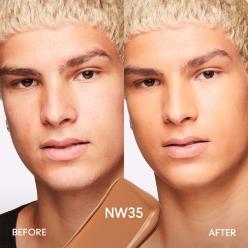 Ein Vorher-Nachher-Vergleich eines jungen Mannes mit Foundation NW35.
