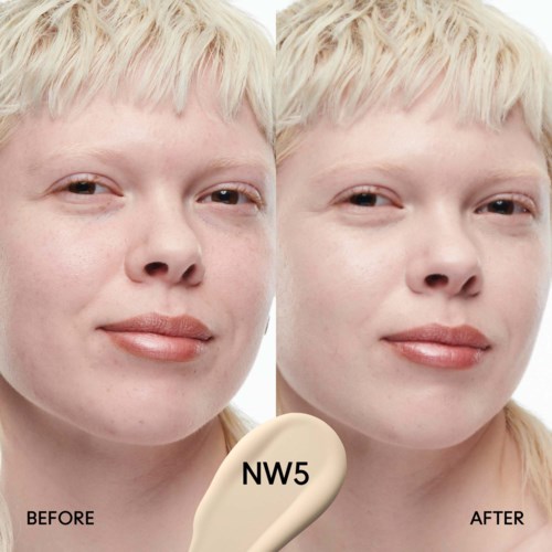 Voor en na foto's laten huidverbetering zien met NW5-product. Duidelijke, gladde huid. Vrouw met blond haar.