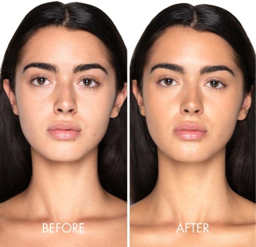 Side-by-side photos show a woman before and after skin treatment, with smoother skin and clearer complexion in the after photo.