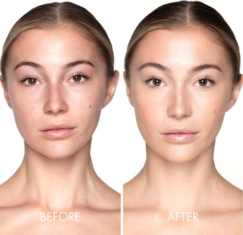 Side-by-side images show a woman with clearer, smoother skin after skincare treatment. The after image shows fewer blemishes.