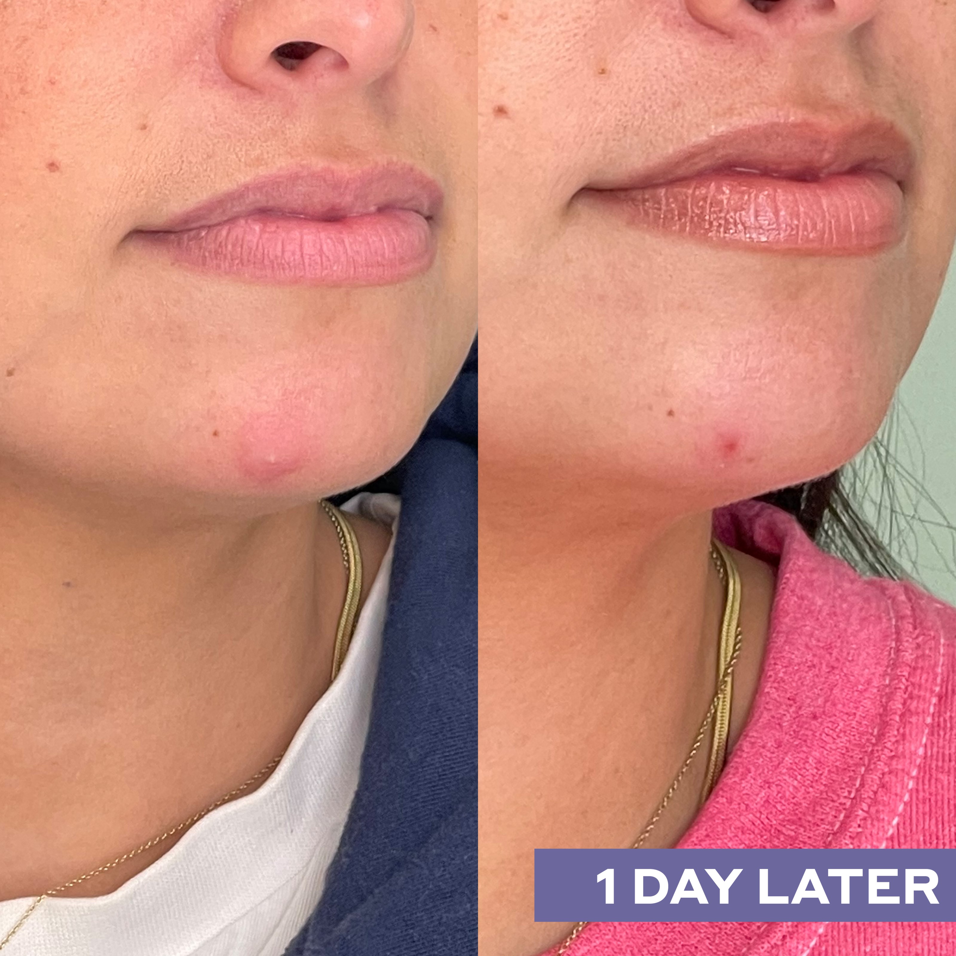 Mario Badescu REPAIRING FACIAL Spray With Hypochlorous Acid 118 ml (obrázok 3)