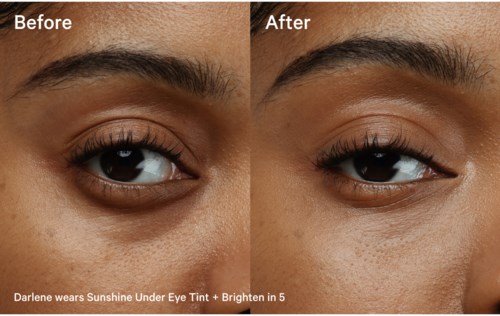 Side-by-side photos showing the eye area before and after using a brightening product.