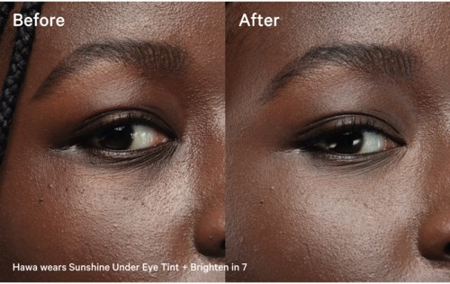 Side-by-side photos show skin improvement around the eye after using a brightening product.