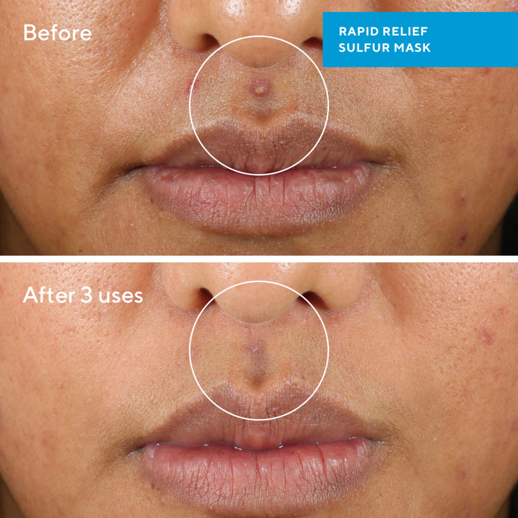Murad Blemish Control Rapid Relief Sulfur Mask 75 ml (obrázok 3)