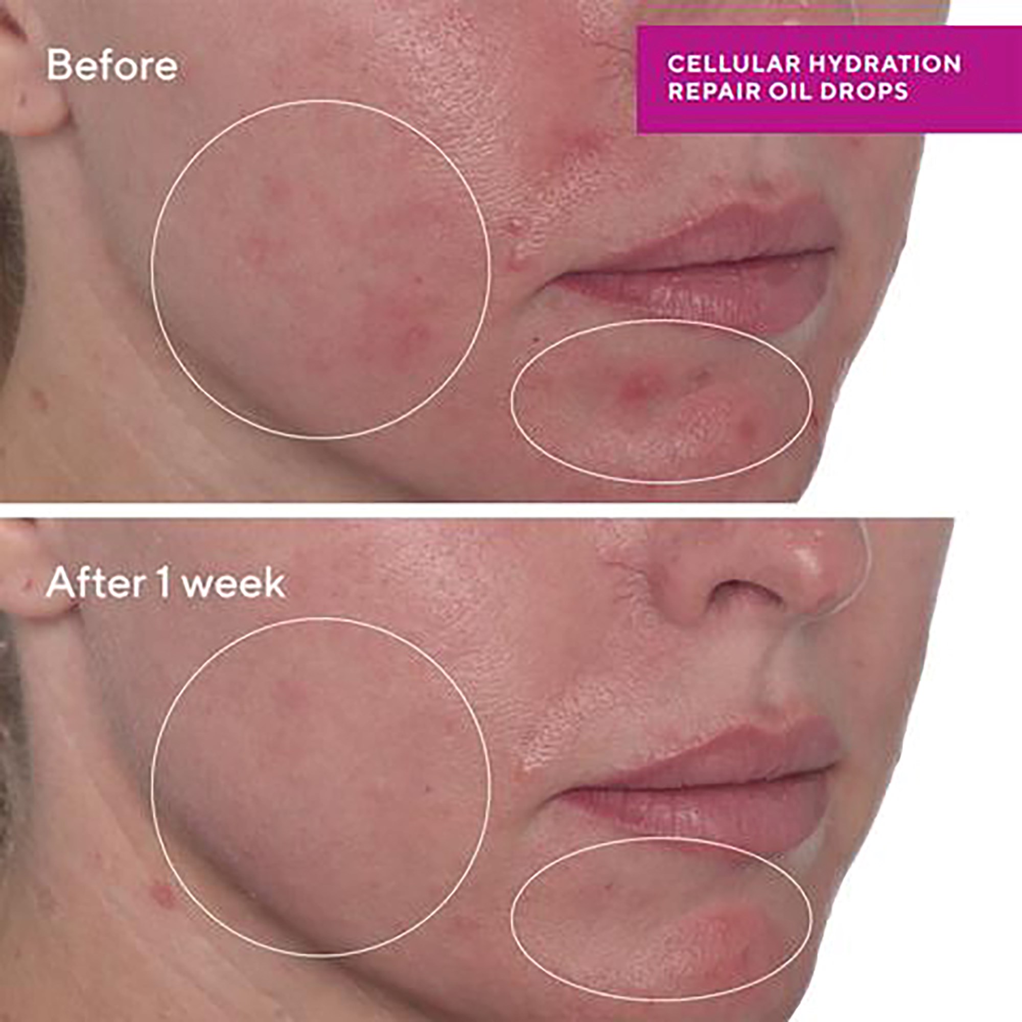 Murad Cellular Hydration Repair Oil Drops 30 ml (obrázok 9)