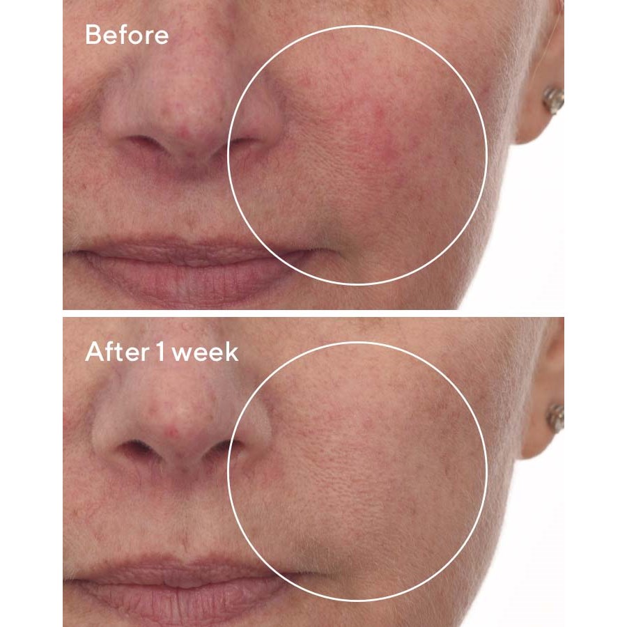 Murad Cellular Hydration Repair Serum 30 ml (obrázok 8)