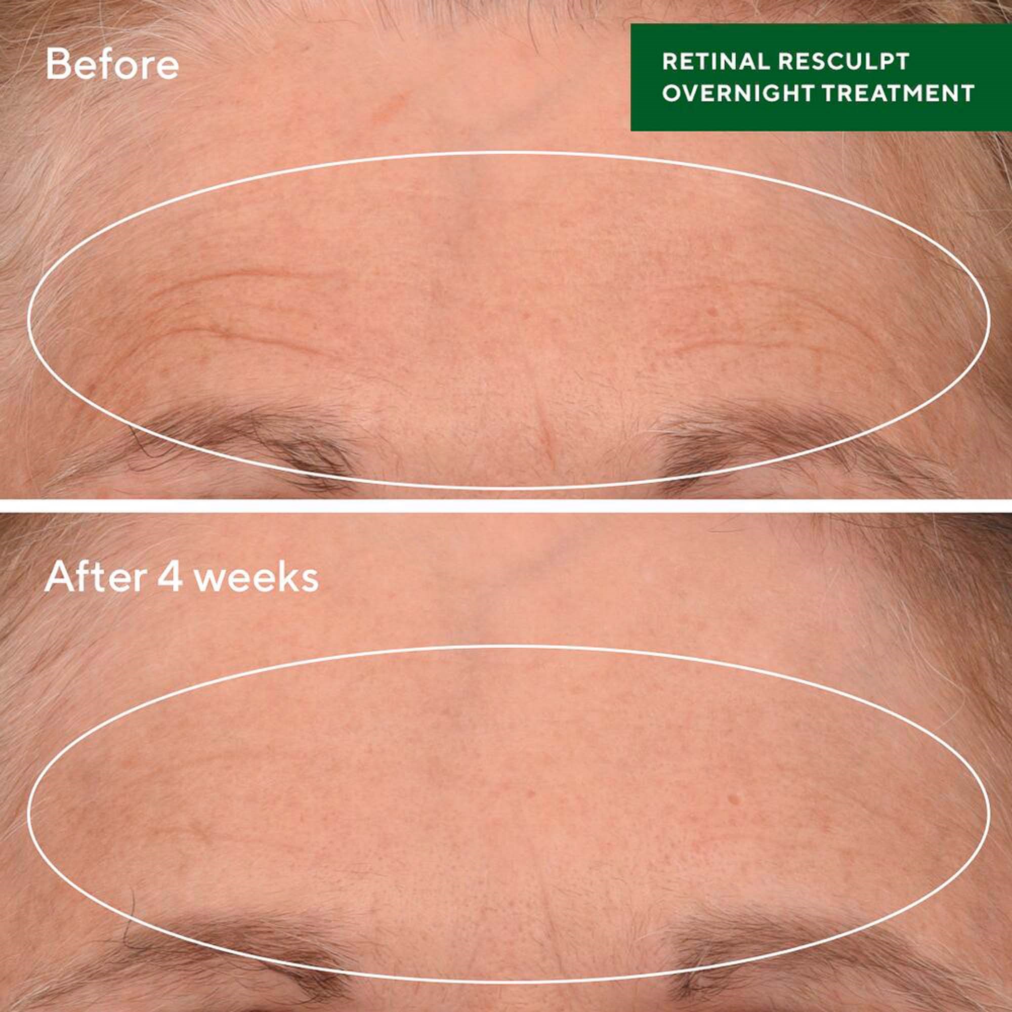 Murad Resurgence Retinal ReSculpt Overnight Treatment 30 ml (obrázok 4)