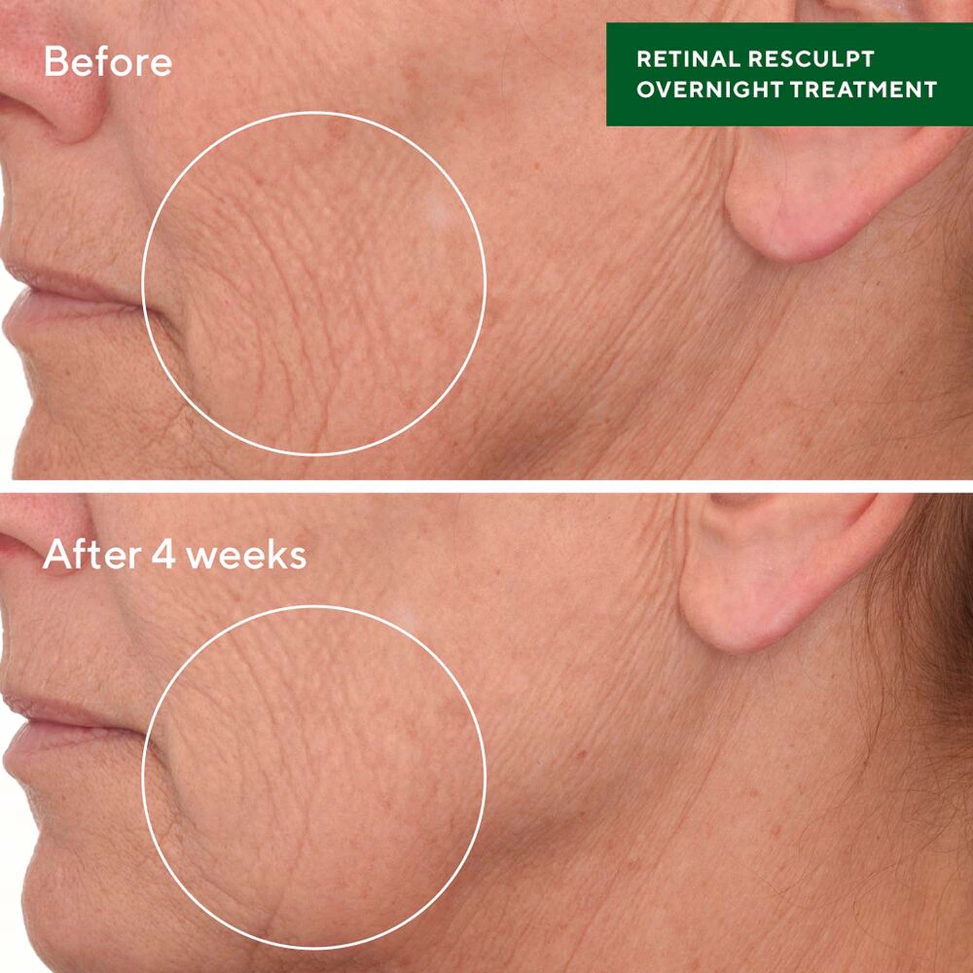 Murad Resurgence Retinal ReSculpt Overnight Treatment 30 ml (obrázok 5)