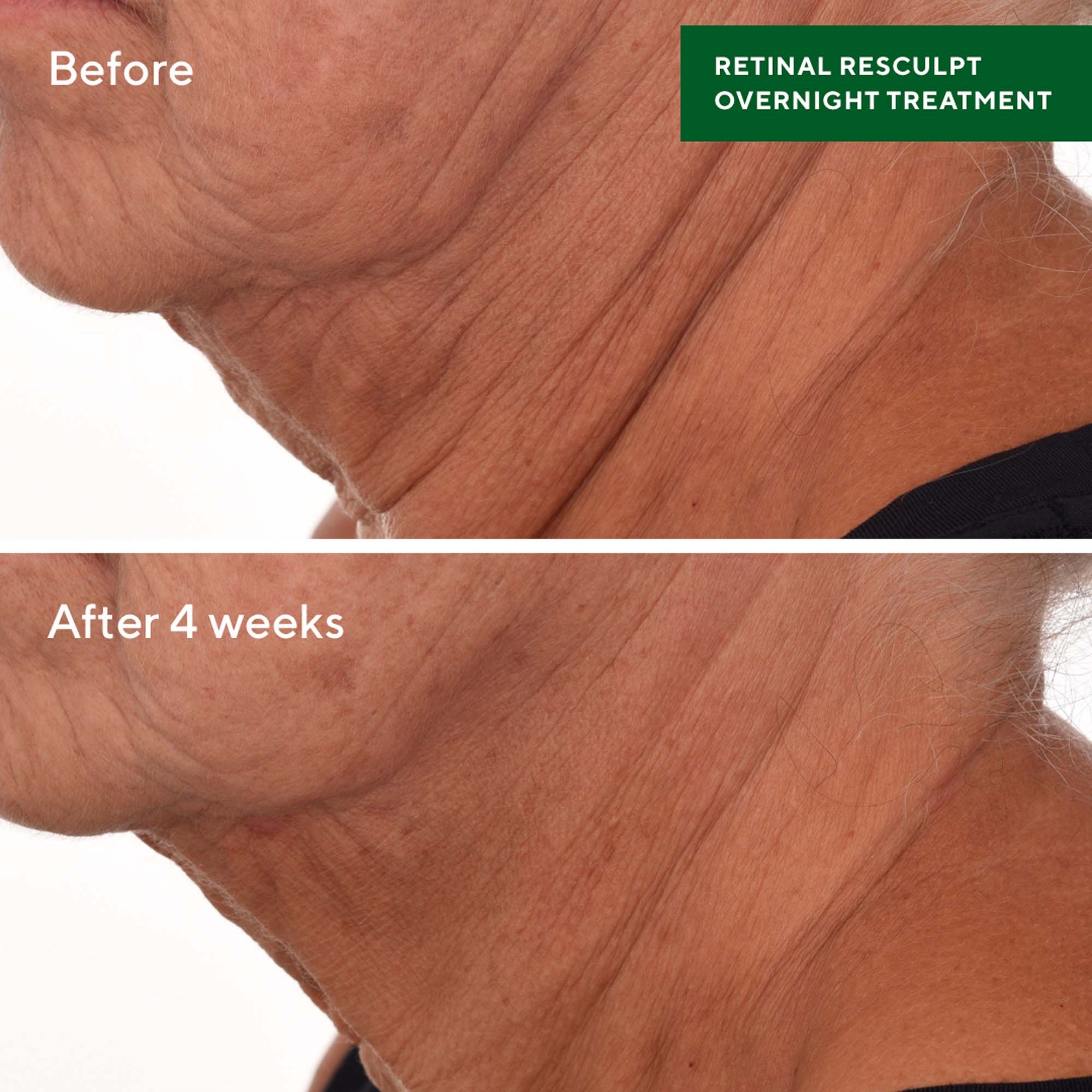 Murad Resurgence Retinal ReSculpt Overnight Treatment 30 ml (obrázok 6)