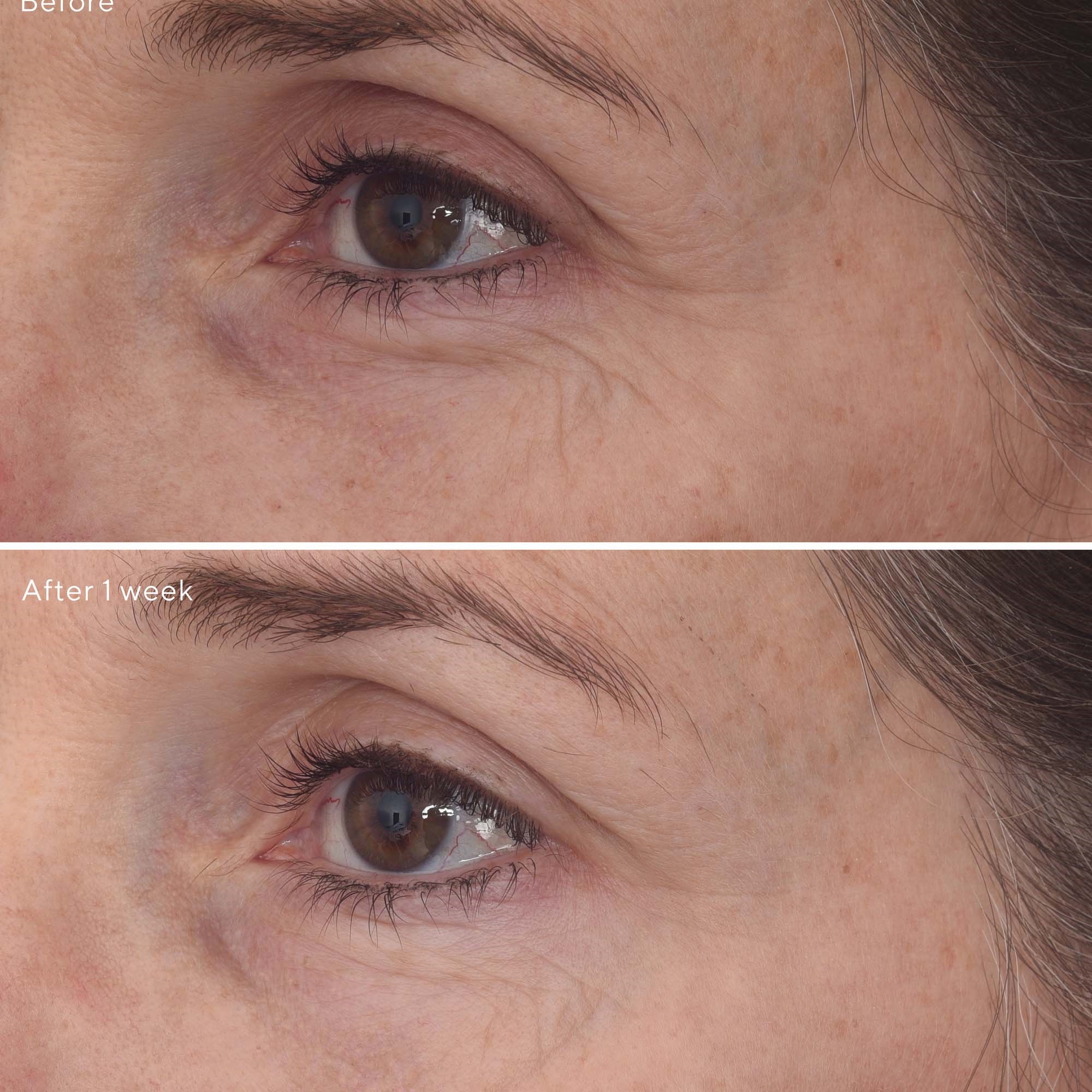 Murad Retinal ReSculpt Eye Lift Treatment (obrázok 10)