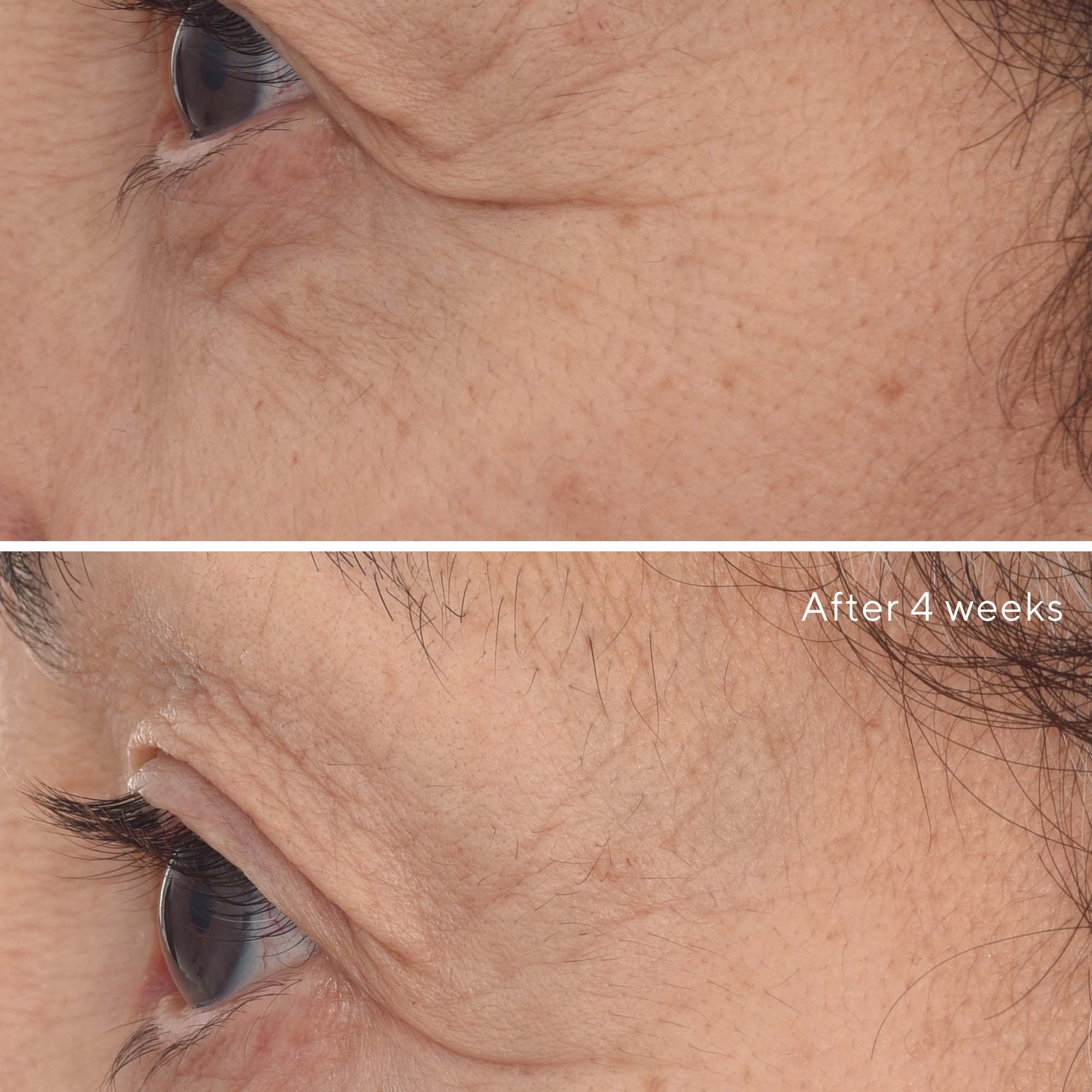 Murad Retinal ReSculpt Eye Lift Treatment (obrázok 11)