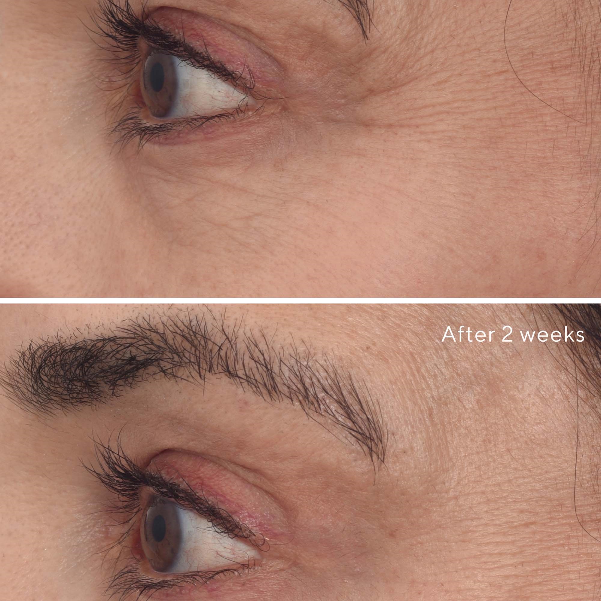 Murad Retinal ReSculpt Eye Lift Treatment (obrázok 9)