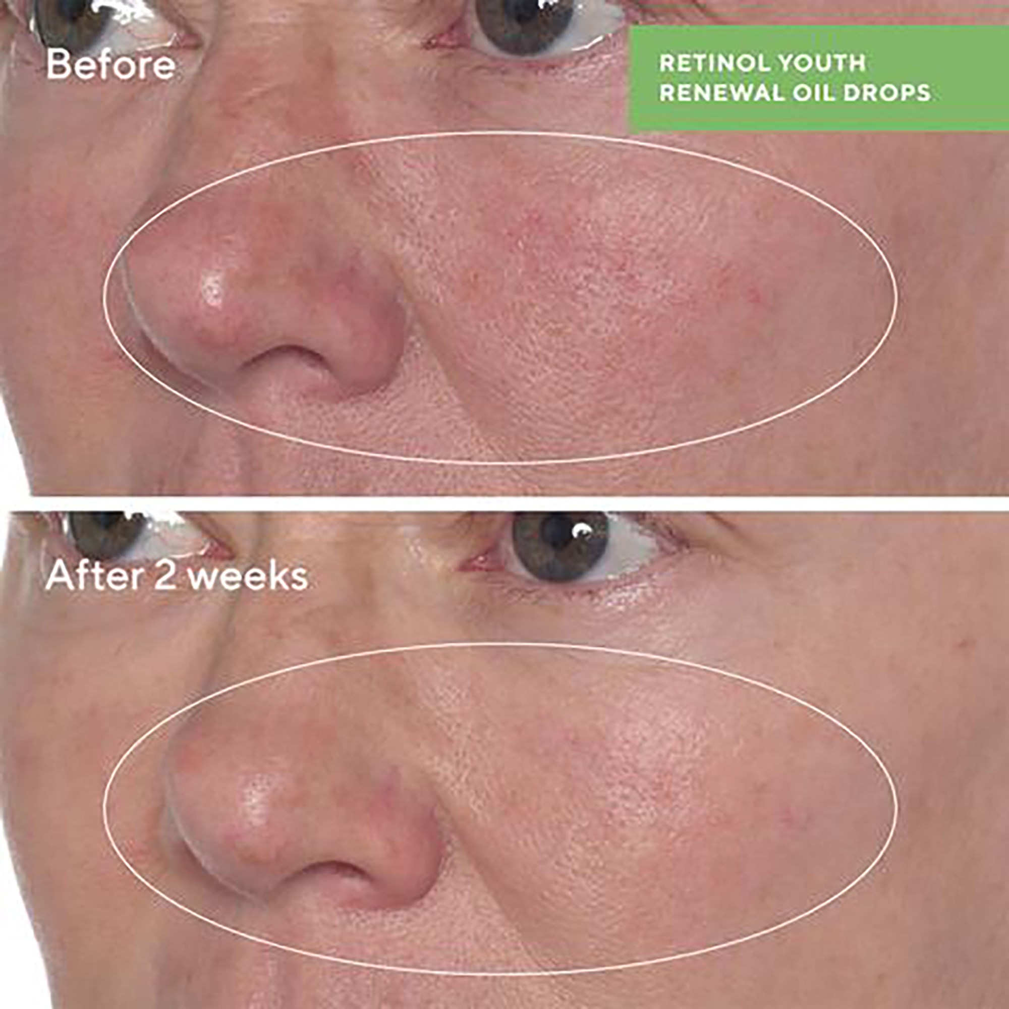 Murad Retinol Youth Renewal Oil Drops 30 ml (obrázok 10)